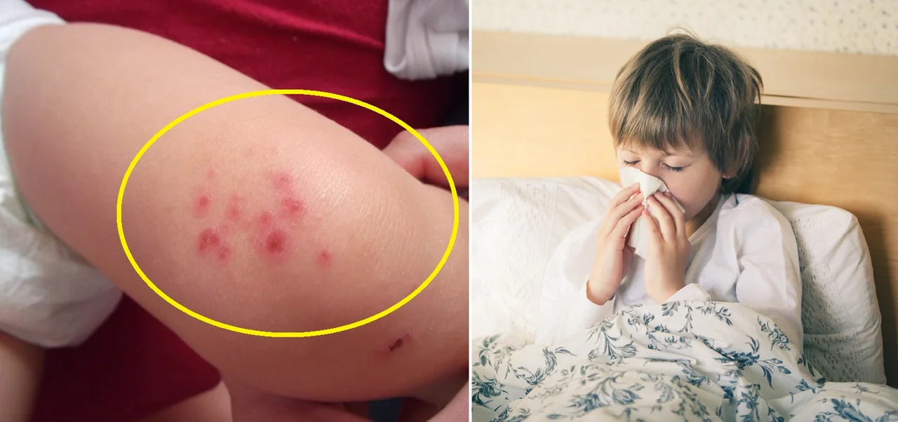 Jak uchronić dziecko przed alergią? Praktyczne i prawdziwe porady!