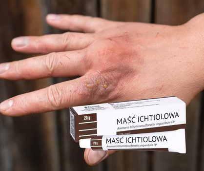 Maść ichtiolowa - HIT z apteki za 5 zł! Bez recepty!