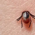 Nowa odmiana kleszcza! Uważaj, jest bardzo niebezpieczny
