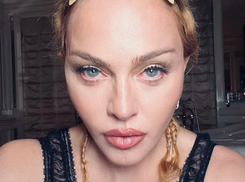 Madonna trafiła na OIOM! Znaleziono ją nieprzytomną! Trasa koncertowa odwołana