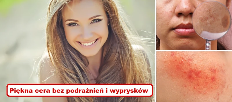 Jeżeli chcesz się cieszyć piękną skórą BEZ PODRAŻNIEŃ I WYPRYSKÓW – pamiętaj o tym!