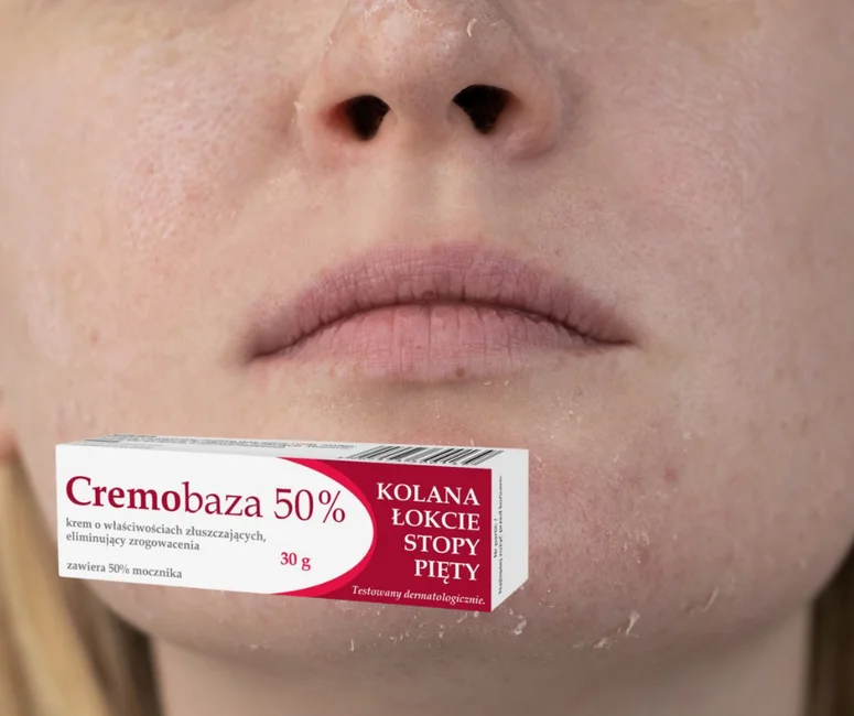 Cremobaza - hit z apteki, który musisz mieć! Trzy stężenia i trzy różne przeznaczenia.