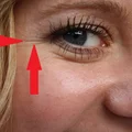 Jak pozbyć się ZMARSZCZEK z okolic OCZU?