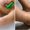 Domowy test na poziom cukru we krwi - kup w aptece. Zadbaj o zdrowie