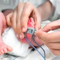 Światowy Dzień Wcześniaka: Zrozumieć, Wsparcie, Działanie