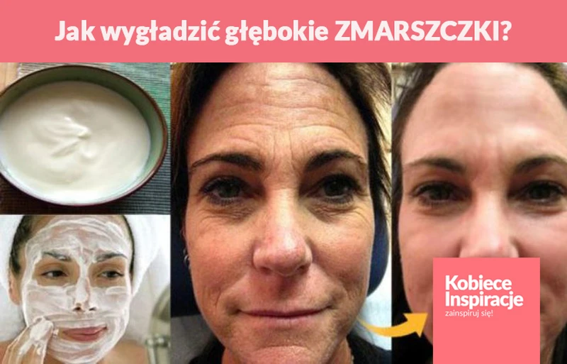 Jak wygładzić głębokie ZMARSZCZKI?
