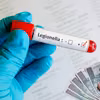 Legionella w czterech województwach! Kto dostanie odszkodowanie?