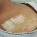 Jak załagodzić męczący kaszel? Wykonaj plaster leczniczy z kilku składników