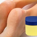 10 zastosowań wazeliny, które ułatwią Ci życie!