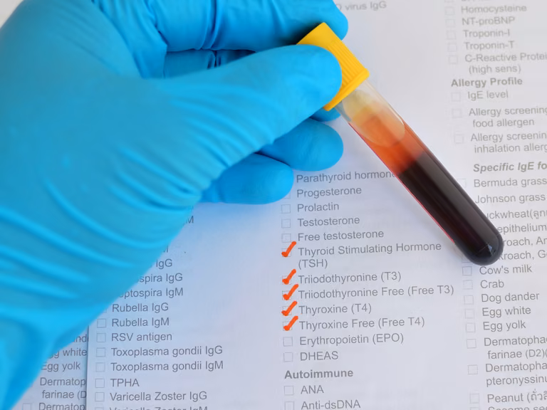 Masz takie objawy wiosną? Sprawdź poziom tych 5 hormonów!
