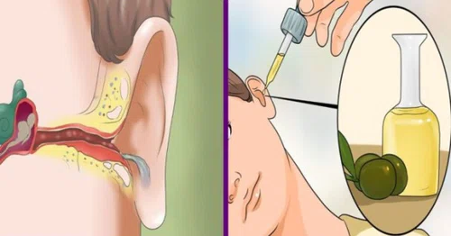 3 najskuteczniejsze domowe sposoby na ból ucha