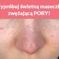 Wypróbuj świetną maseczkę zwężającą PORY!