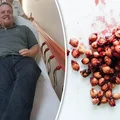 Ten mężczyzna prawie umarł po zjedzeniu 3 pestek wiśni