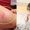 Jak uchronić dziecko przed alergią? Praktyczne i prawdziwe porady!