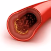 Sposób na obniżenie cholesterolu!