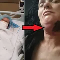 Najpierw bolał ją ząb, chwilę później walczyła o życie. Trwa zbiórka na jej operację