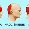 Pozbądź się BÓLU GŁOWY w 5 minut bez TABLETEK!