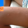 Jak przygotować naturalny i skuteczny spray na komary?