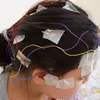Międzynarodowy Dzień Epilepsji: Zwiększanie Świadomości i Wsparcie dla Osób Dotkniętych