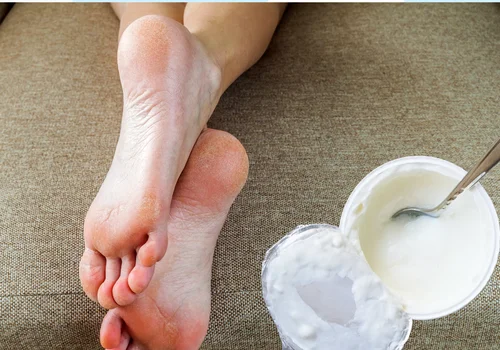 Sięgnij do lodówki i nałóż na 20 minut! Twoje stopy będą gładkie jak aksamit