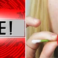 UWAGA: znany lek na trądzik wycofany z obrotu! [20.03.2019]