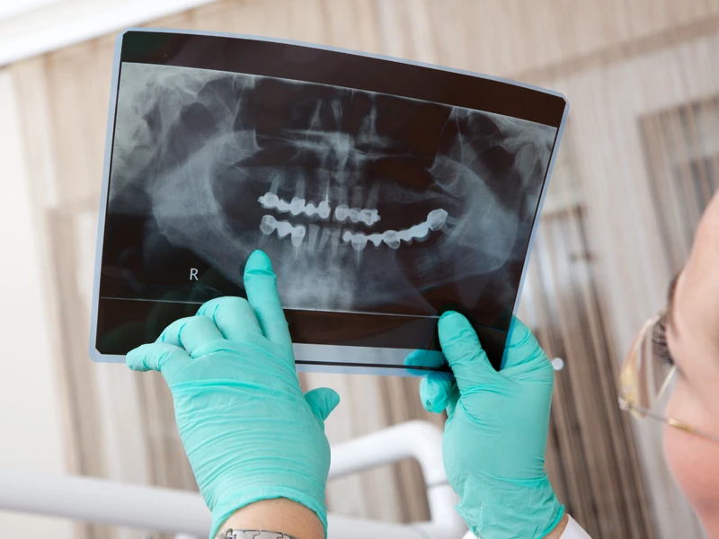Usługi dentystyczne na NFZ! Więcej darmowych zabiegów już w tym roku! (LISTA)