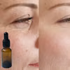 Jak prawidłowo stosować Retinol? 9 kluczowych zasad