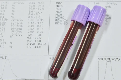 Te 10 badań krwi są niezbędne dla kobiet! Mogą wcześnie wykryć zagrożenia zdrowia!