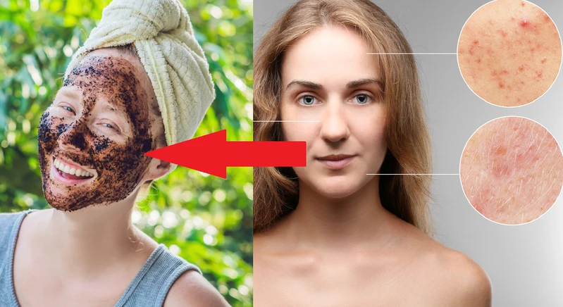 Jak zregenerować skórę po zimie i przygotować ją na wiosnę?