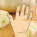 Wypróbuj naturalny sposób na usunięcie BRODAWEK!
