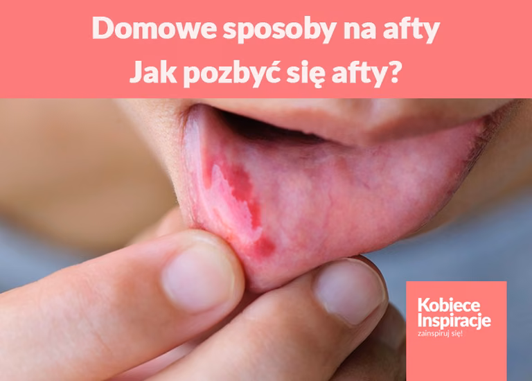 Domowe sposoby na afty - jak pozbyć się afty?