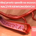 Wypróbuj prosty sposób na oczyszczenie NACZYŃ KRWIONOŚNYCH!