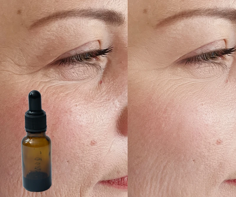 Jak prawidłowo stosować Retinol? 9 kluczowych zasad