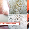Poznaj 2 najlepsze sposoby na ZASKÓRNIKI