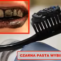 HIT! Czarna pasta która WYBIELI ZĘBY!