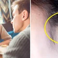 Pewnego dnia przestała słyszeć męski głos! Diagnoza była zaskoczeniem...