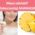 Masz odciski? Wykorzystaj ANANASA!