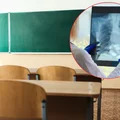 Potwierdzony przypadek gruźlicy w polskiej szkole! Setki dzieci i dorosłych zagrożonych - Sanepid rozpoczął procedury