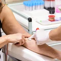 10 badań, które warto wykonywać raz do roku! La lista może uratować twoje zdrowie