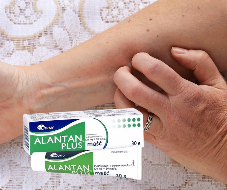 Alantan: maść na wszystkie problemy skórne! HIT z apteki za 6 złotych