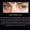 Super sposób na podpuchnięte oczy