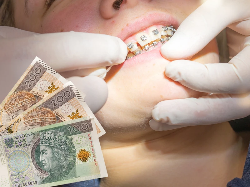 500 plus na dentystę dla każdego! Dofinansowanie, o którym niewiele osób wie!