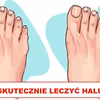 Masz HALUKSY? Sprawdź jak sobie z nimi radzić!
