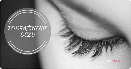 Podrażnione oczy – jak im pomóc?
