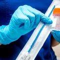 Zaskakujący przełom w medycynie! Nowy test demaskuje chorobę, która dotyka wielu kobiet.