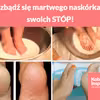 Pozbądź się martwego naskórka ze swoich STÓP!