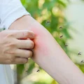 Nowe badania nad komarami: Co tak naprawdę przyciąga te owady do ludzi?