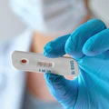 Szybki i tani test na koronawirusa? Przełomowy wynalazek polskich naukowców!