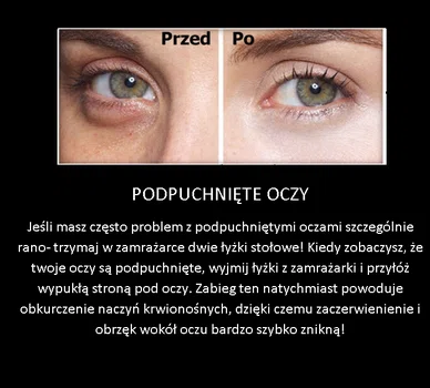 Super sposób na podpuchnięte oczy