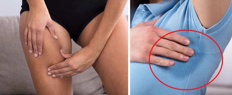Lato może przysparzać nam wiele problemów urodowych. Jak ich uniknąć?